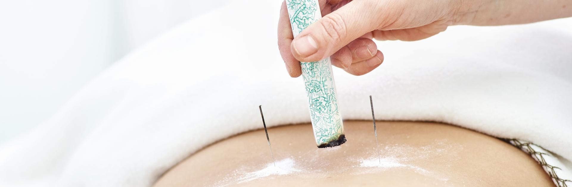 acupuncture bath needles